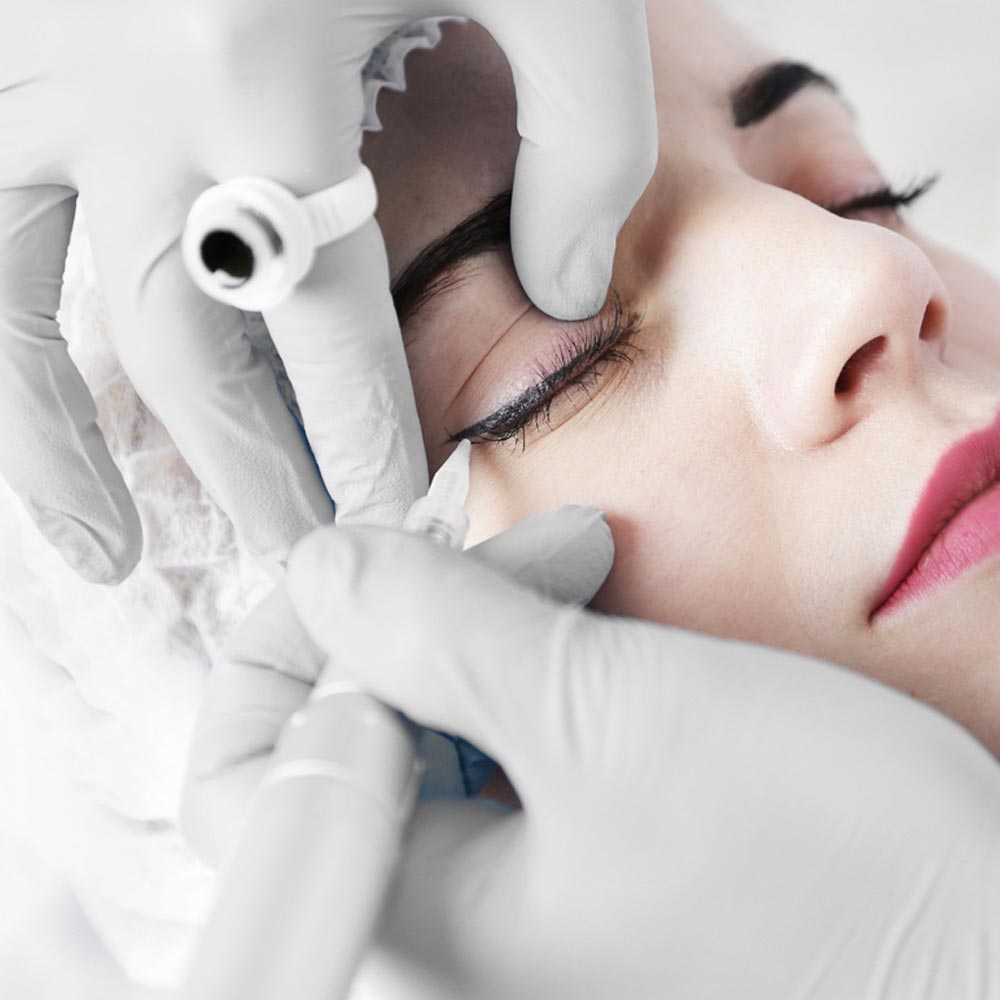 PMU AKUT Sachet 2,5ml